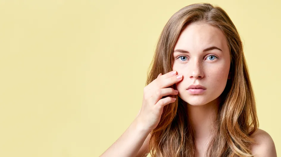 4 trucos de maquillaje para cubrir impurezas y granitos del rostro