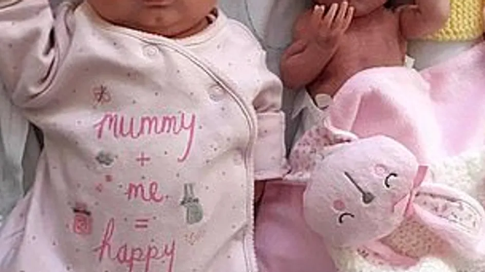 Des sœurs jumelles survivent après être nées avec 15 os fracturés et aucune chance de survie