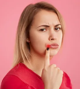 Herpes labial: los mejores consejos y remedios caseros para acabar con él