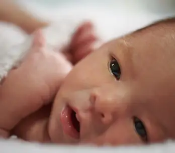 Bebe A Des Boutons Qu Est Ce Que C Est Comment Reagir