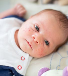 Poussee Dentaire Chez Le Bebe Fini La Galere