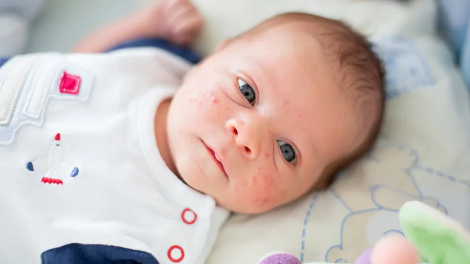 La roséole du bébé : que faire contre cette maladie infantile ?