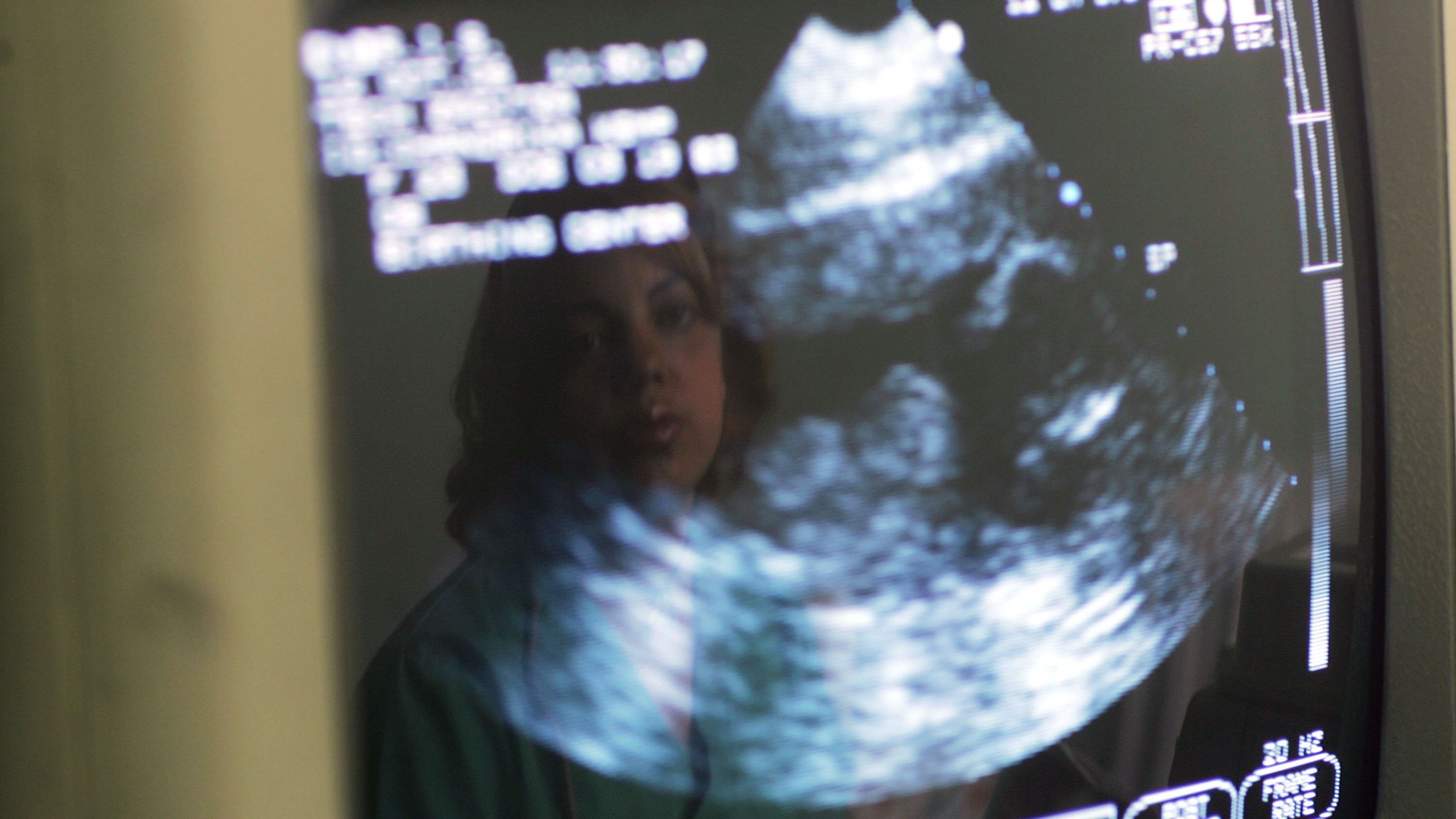 Effrayee Cette Maman Decouvre Une Echographie Pas Comme Les Autres