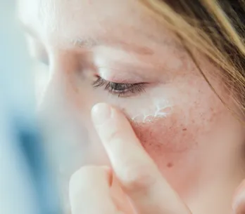 Granitos debajo de la piel: ¿por qué ocurre y cómo tratarlos?