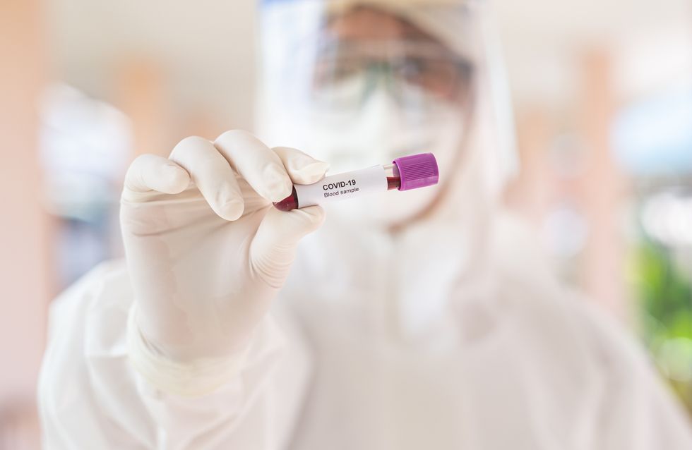 Coronavirus: Wie ist das Virus entstanden?