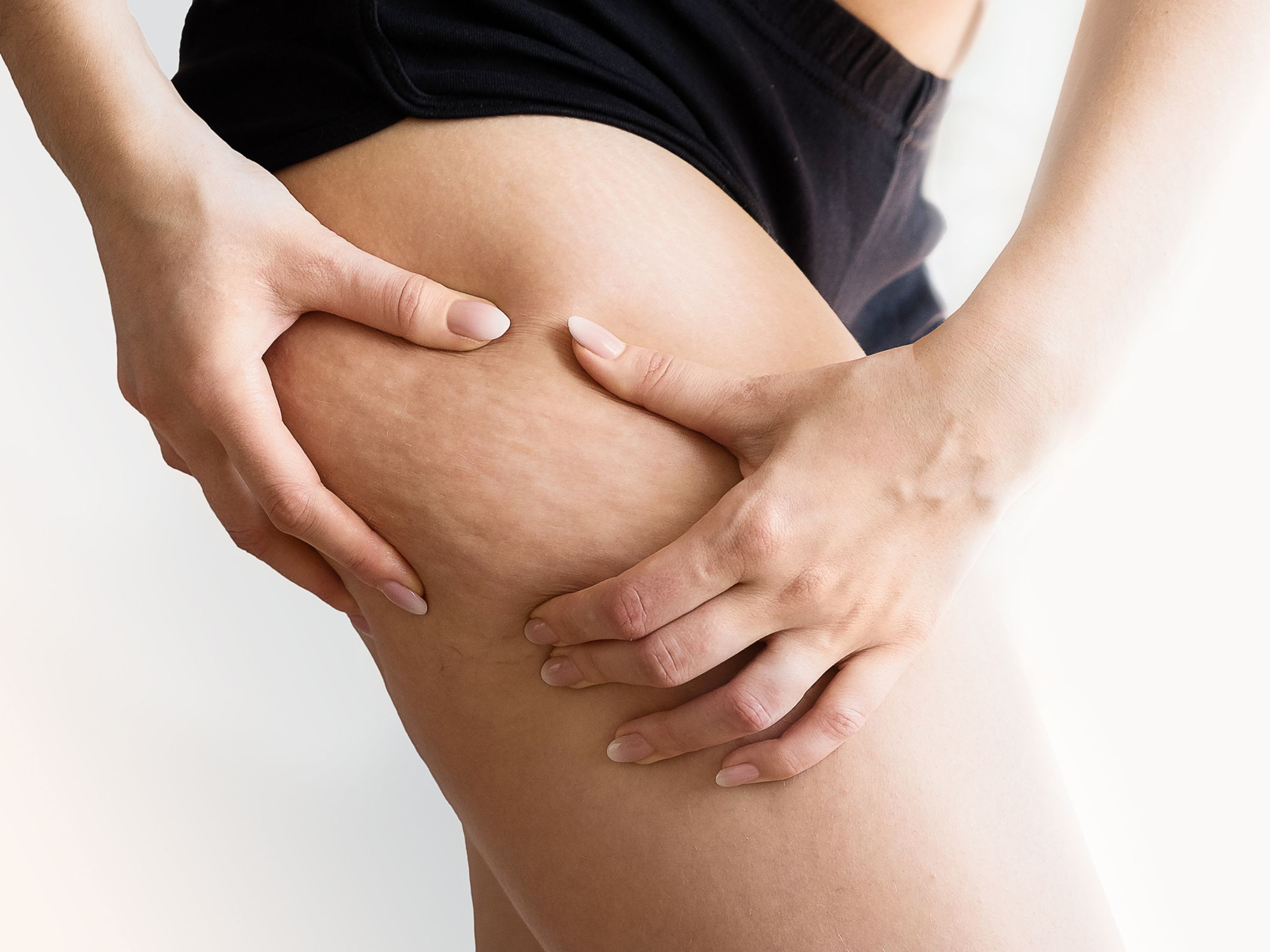 Cellulite : les soins, crèmes et massages anti-cellulite