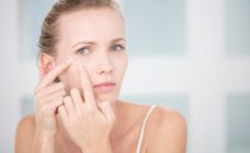 Cicatrices d'acné, comment s'en débarrasser durablement ?
