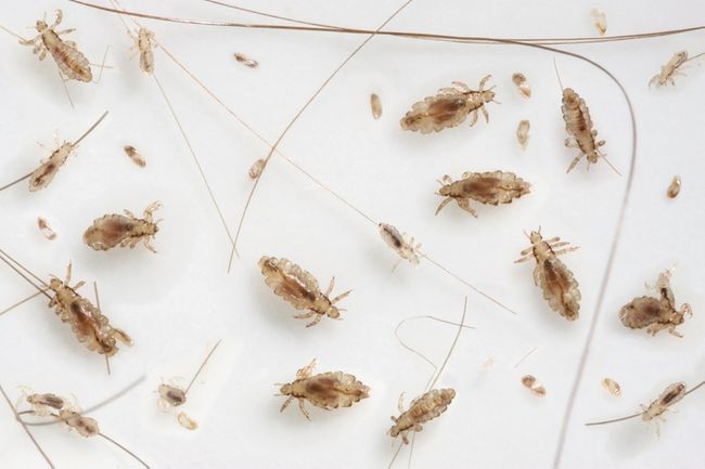 Sognare Pidocchi Significati E Interpretazioni