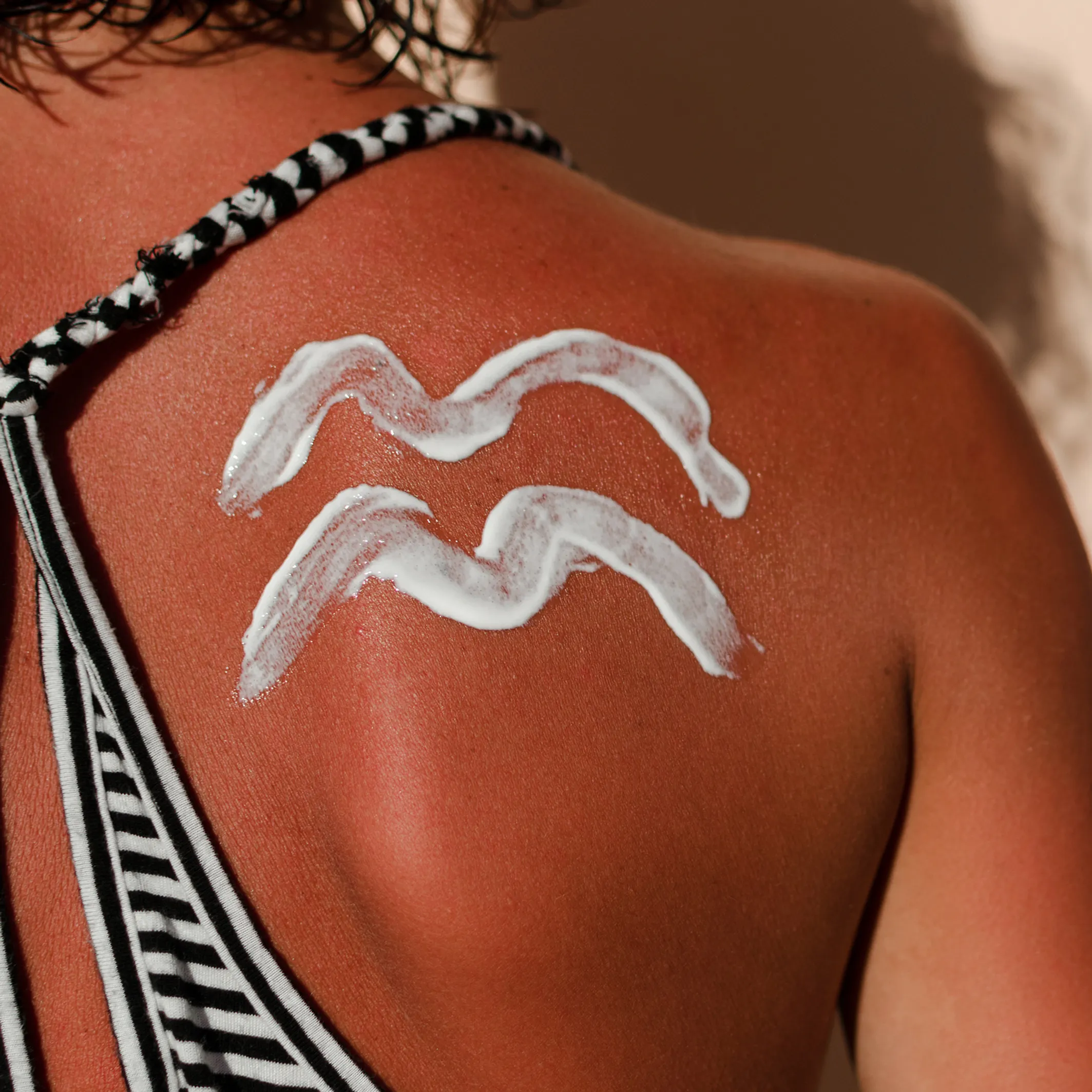 Hausmittel Gegen Sonnenbrand Die Helfen Am Besten