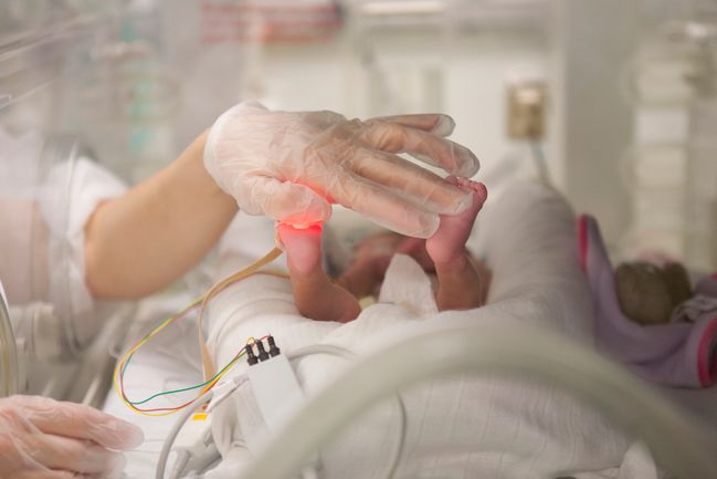 Bebe Premature Qu Est Ce Que La Prematurite Et Comme Est Elle Prise En Charge