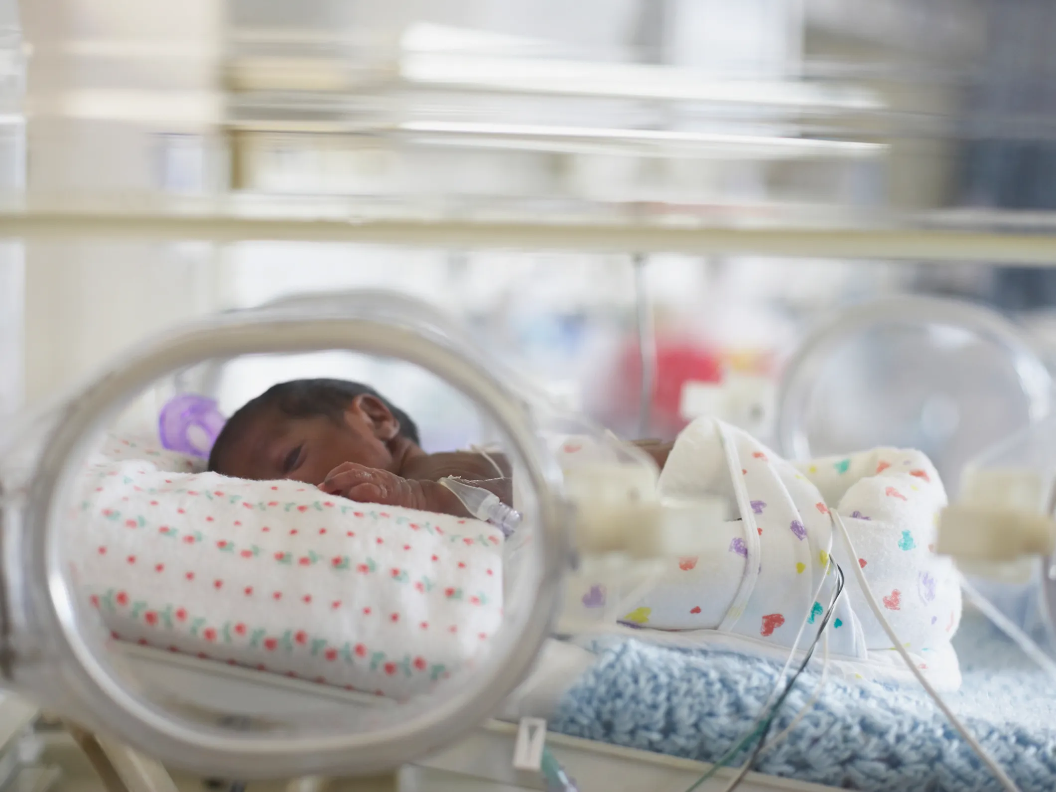 Bebe Premature Qu Est Ce Que La Prematurite Et Comme Est Elle Prise En Charge