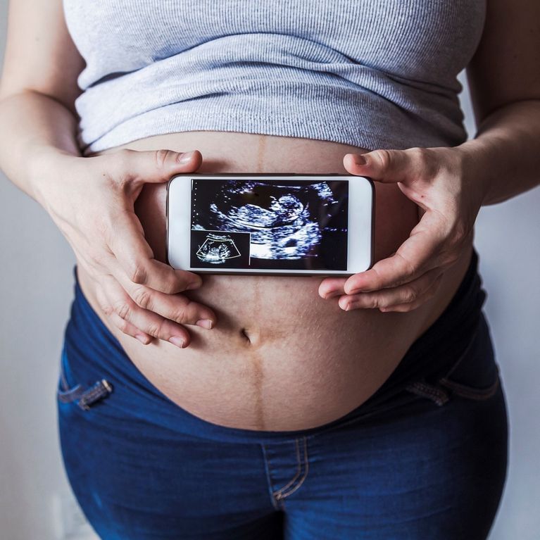 Camera Gestazionale Dove Si Sviluppa L Embrione In Gravidanza