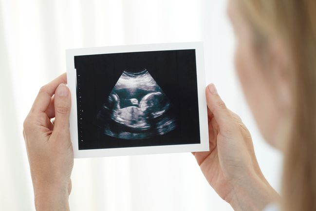 Camera Gestazionale Dove Si Sviluppa L Embrione In Gravidanza