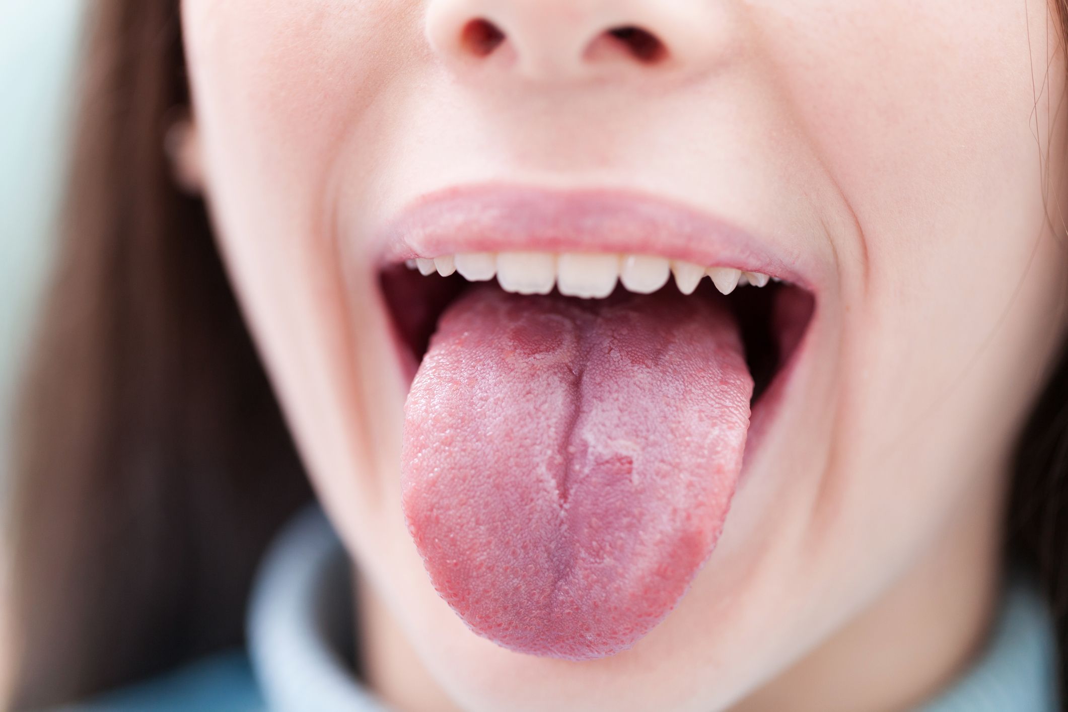 Macchie sulla lingua: quali sono le cause più comuni? • musanews