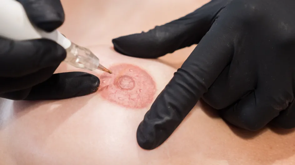 Cancer du sein : la 3D-pigmentation des aréoles offerte dans les instituts MAUD