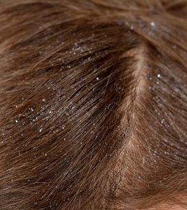 Palline Di Grasso Come Rimediare A Questo Odioso Inestetismo