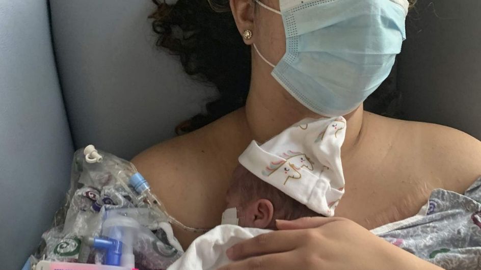 Ce Nourrisson Premature De 340 Grammes Est L Un Des Plus Petits Bebes Du Monde