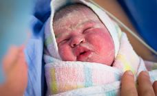 Bebe A La Peau Rouge Qu Est Ce Que C Est Comment Reagir