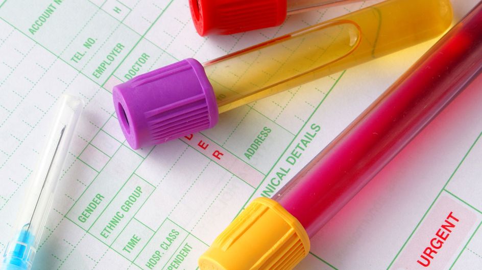 Come Leggere Gli Esami Del Sangue Cosa Significano I Valori