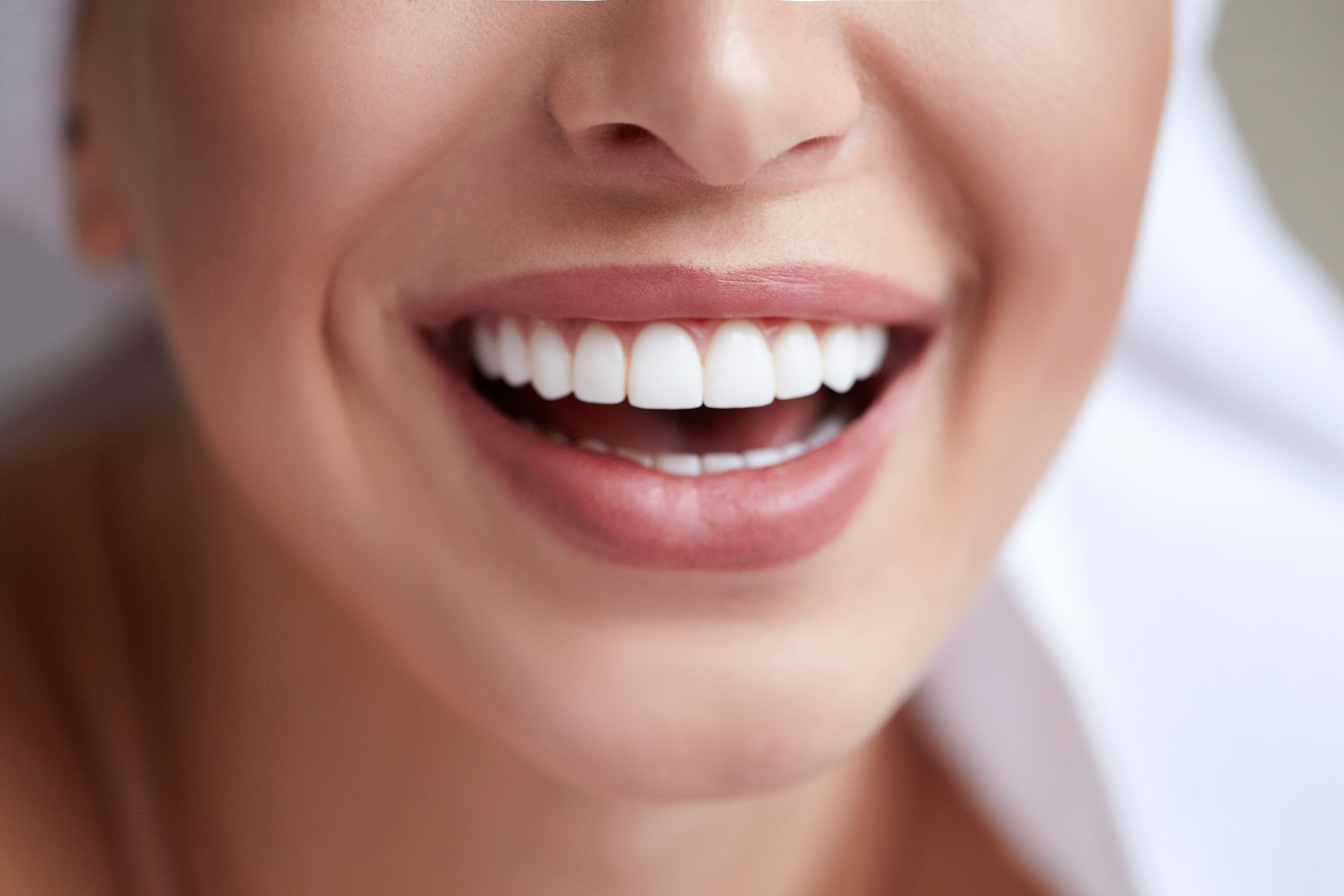 A quoi servent les facettes dentaires ?
