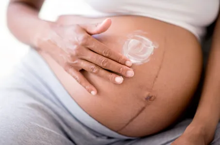 Grossesse : à quoi correspond la ligne brune sur le ventre des femmes  enceintes ? : Femme Actuelle Le MAG