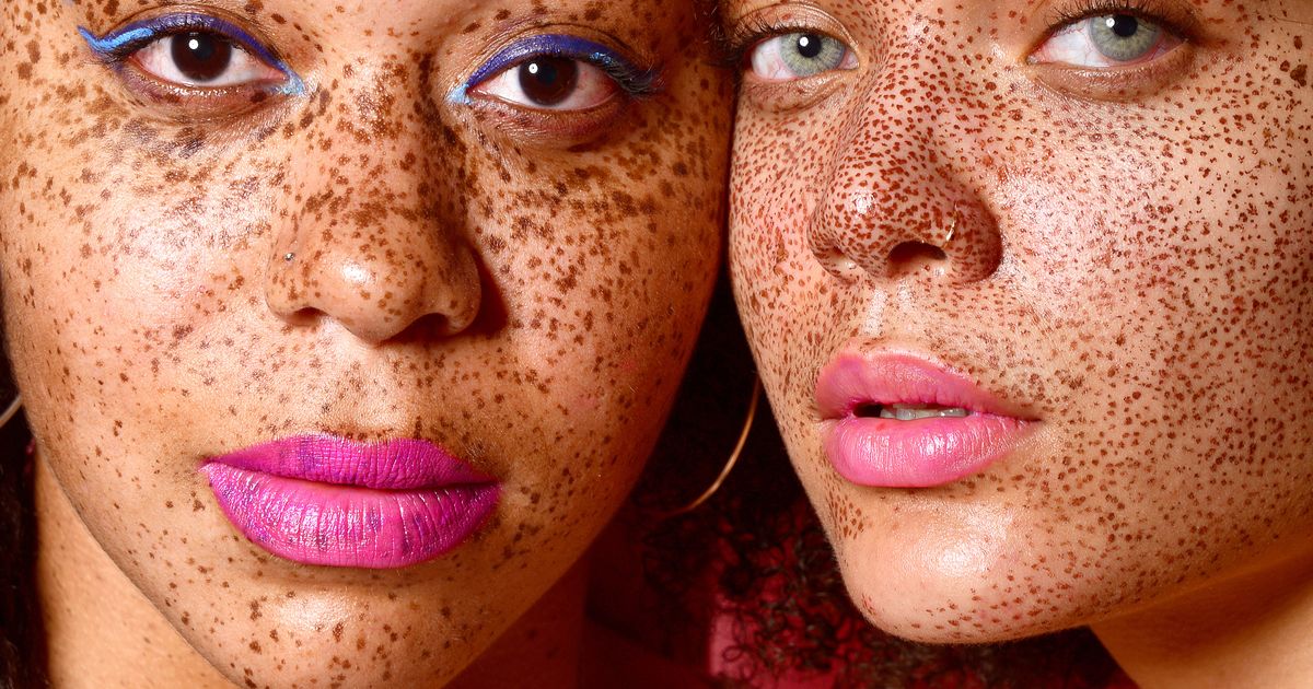 Taches de rousseur : et si on en faisait un atout beauté