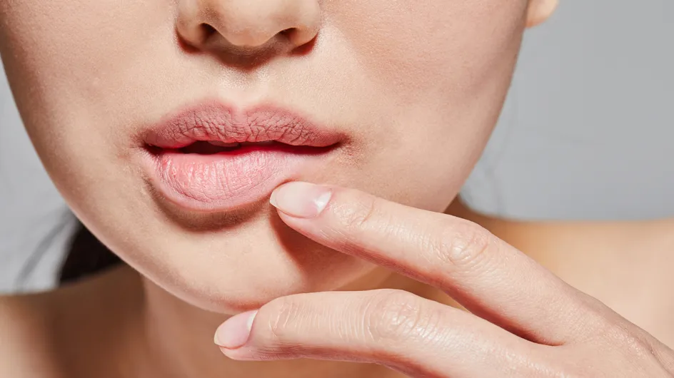 Labbra secche: consigli e rimedi per renderle morbide e rimpolpate
