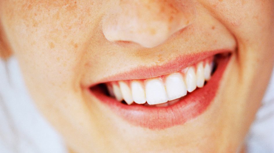 Come usare l’olio di cocco per sbiancare e pulire i denti