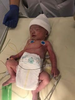 Prematurite Les Photos Avant Apres De Vos Petits Guerriers Qui Donnent De L Espoir