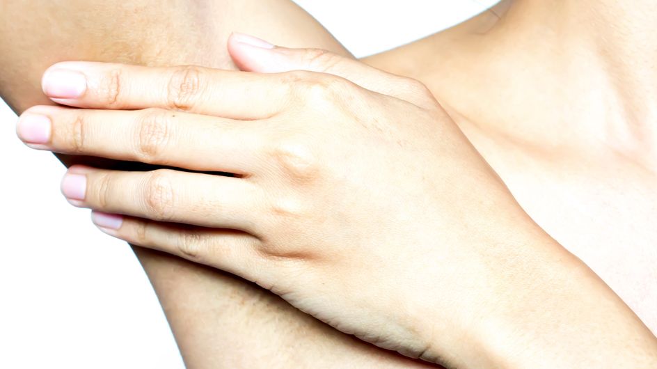Eczéma aisselle les symptômes, les causes et les solutions
