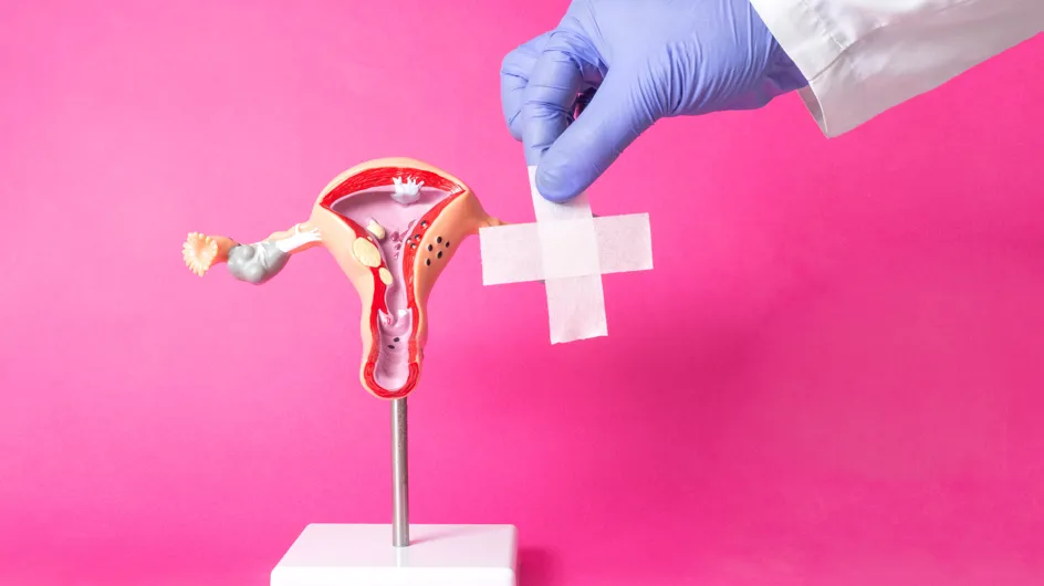 Cisti ovarica: tutto quello che devi sapere