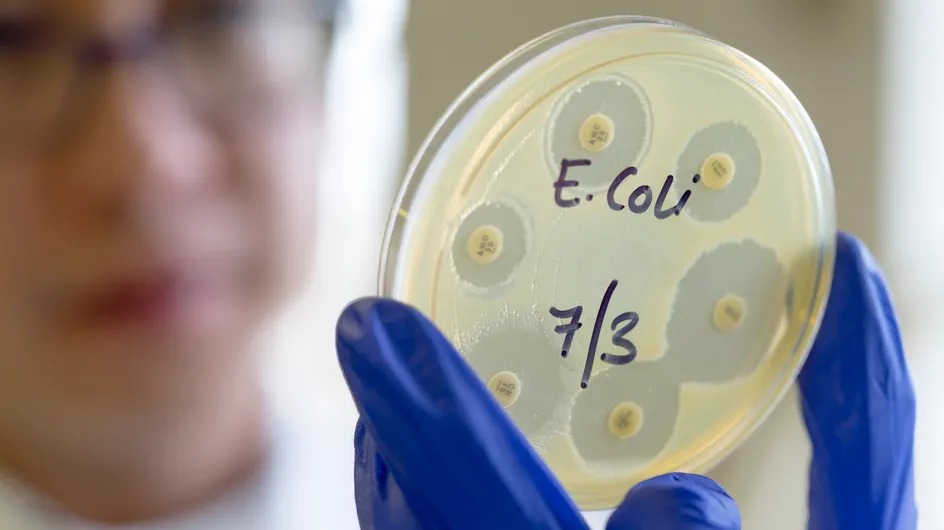 Escherichia coli: cos’è e quando può essere pericoloso