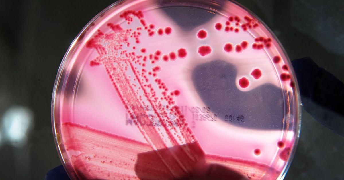 Streptocoque A : tout ce qu'il faut savoir sur cette bactérie qui a tué ...