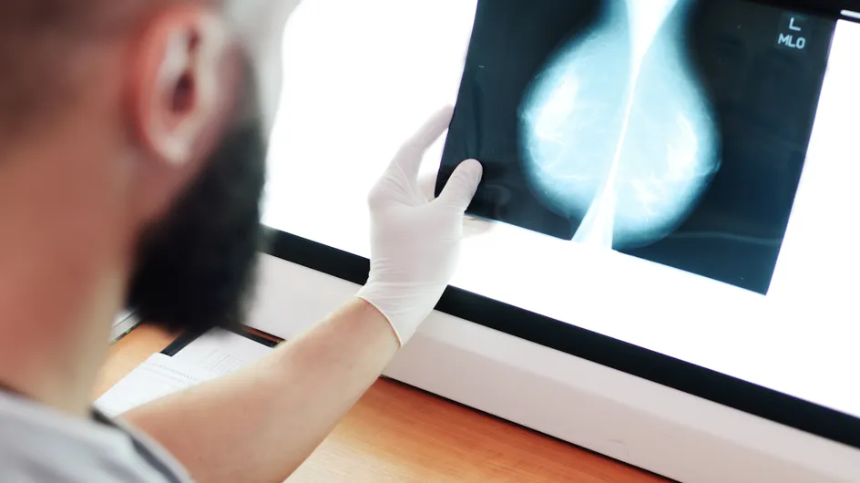 Mamografías con IA detectan el cáncer de mama un 20% más según un estudio
