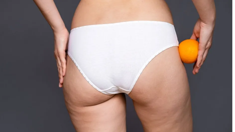 Cellulite : l'activité la plus efficace pour se débarrasser de cette peau d'orange