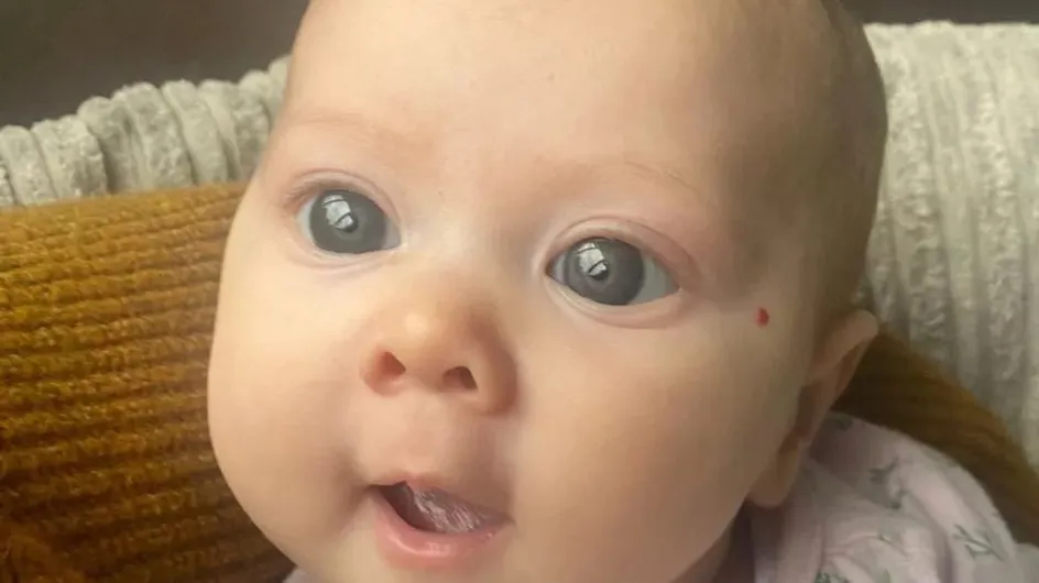 Les grands yeux bleus magnifiques de leur bébé cachaient en réalité un terrible diagnostic de leur médecin