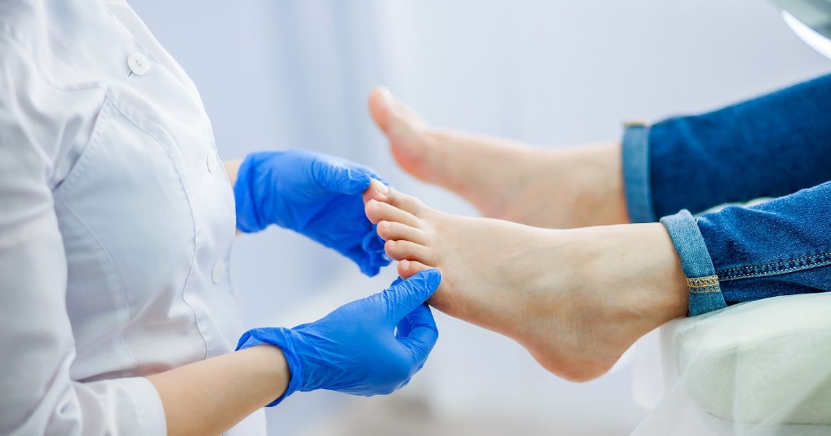 Cholestérol : voici comment repérer les premiers signes grâce à vos ongles de pieds, selon un cardiologue