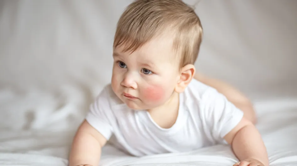 Comment identifier une peau atopique chez son bébé ?