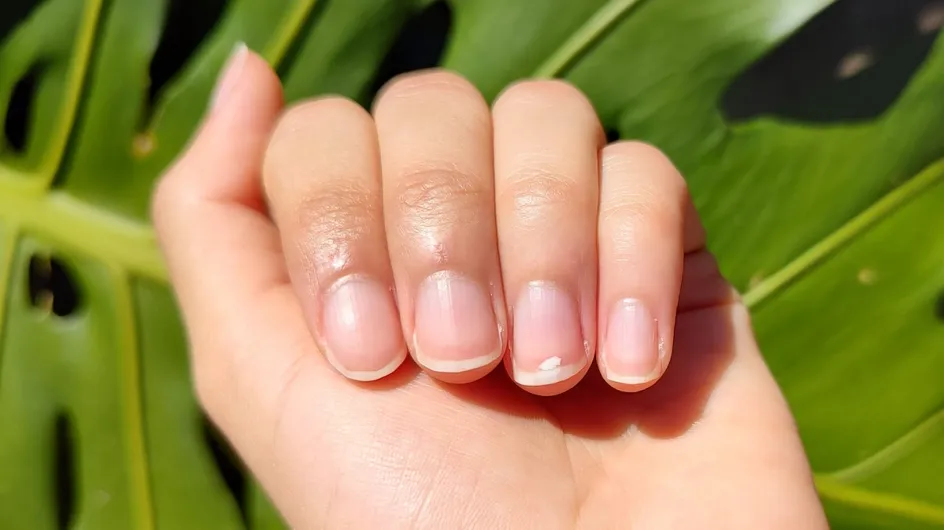 Manchas blancas en las uñas: ¿Mito del calcio o señal de alerta? ¡Farmacéutico te lo explica!