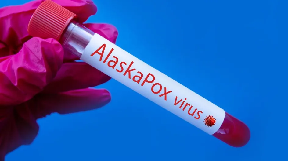 Alaskapox : qu’est-ce que cet étrange virus qui vient de faire un mort ?