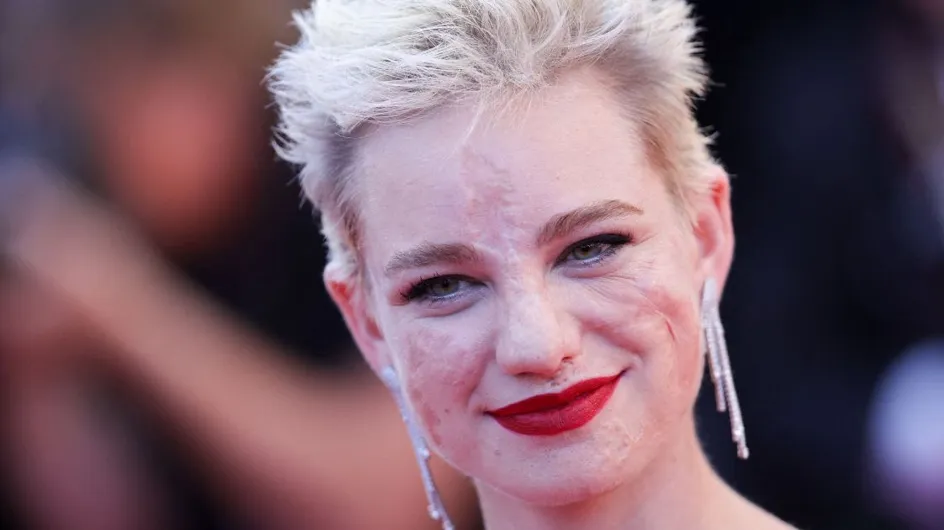 Festival de Cannes 2024 : une star amputée des 4 membres fait sensation sur le tapis rouge