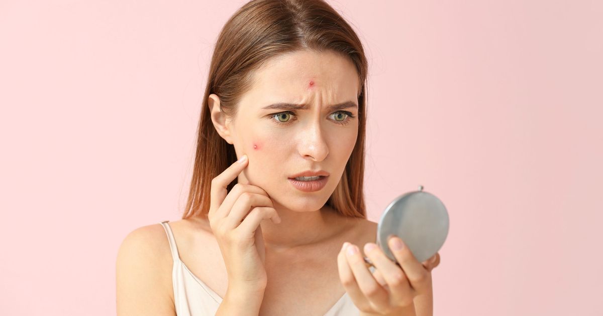 Bouton de stress sur le visage comment le reconnaître et s’en débarrasser