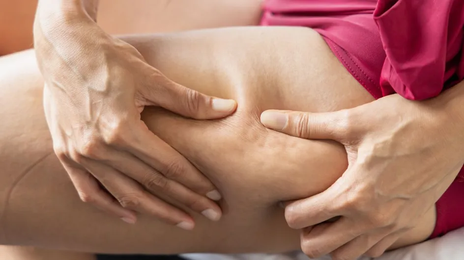 Cellulite : voici la technique de massage anti-cellulite la plus efficace pour l’éliminer rapidement, selon une experte