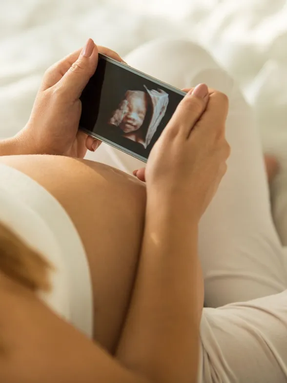 ¿En que consiste una ecografía 3D? Te contamos cuánto cuesta y cuándo debes realizarla