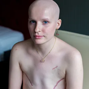This Is What Living With Breast Cancer Really Looks Like