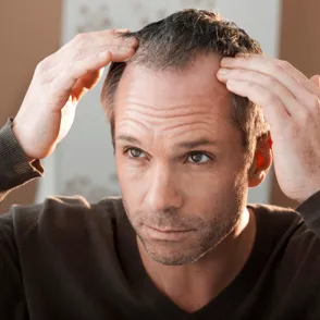 ¡Piérdele el miedo a los trasplantes de pelo!