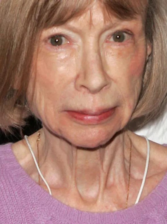Joan Didion, la musa que colapsó las redes y enamoró a Céline