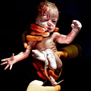 Cuando la vida se mide en segundos: Asombrosas fotografías de bebes justo después de nacer