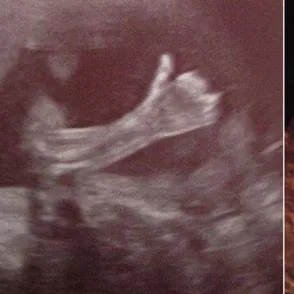 Hallo Mami! Alles gut hier drin! Babys erste Nachricht aus Mamas Bauch