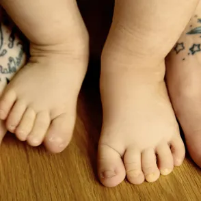 Un matrimonio se tatúa la mancha de nacimiento de su hija para no hacerla sentir diferente